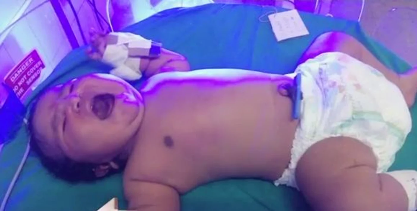 
    Cea mai grea fetiță nou-născută din India a avut 6,8 kilogrameFoto: captură video  