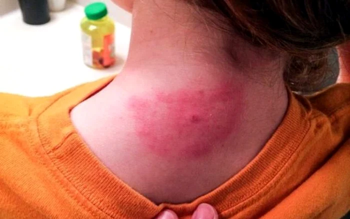 
    Sursa foto: Antena 1  