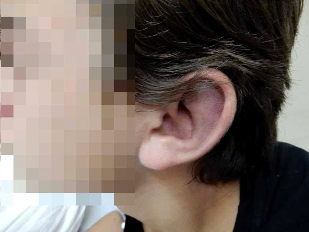 
    Băiețelul bătut de tată a ajuns la spital după ce i-a trimis mamei mesaje disperatefoto: news.ro  