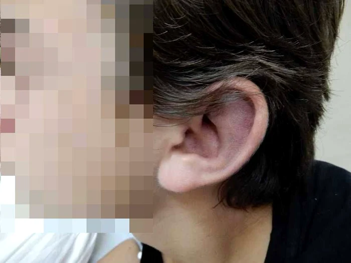 Băiețelul bătut de tată a ajuns la spital după ce i-a trimis mamei mesaje disperatefoto: news.ro