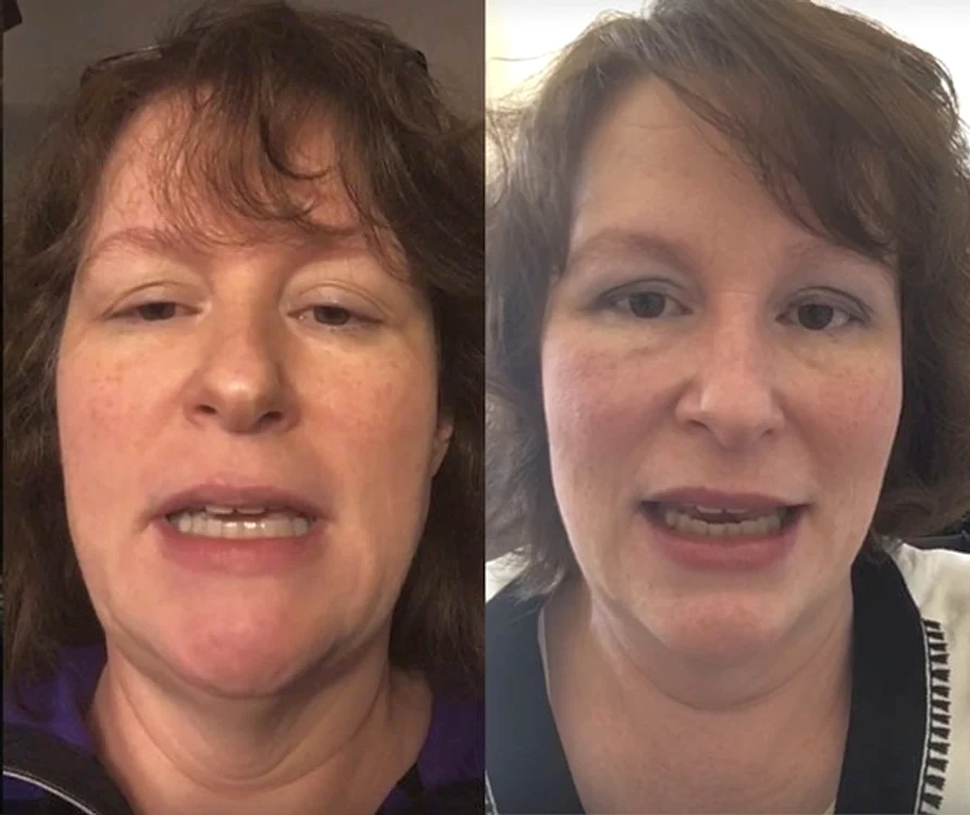 
    Linda Pereira vorbeşte în fiecare zi cu alt accent, iar afecţiunea nu dă semne de vindecarecaptură video  