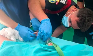 un copil de doi ani a ramas cu mana prinsa in masina de tocat foto isu mures png