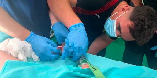un copil de doi ani a ramas cu mana prinsa in masina de tocat foto isu mures png