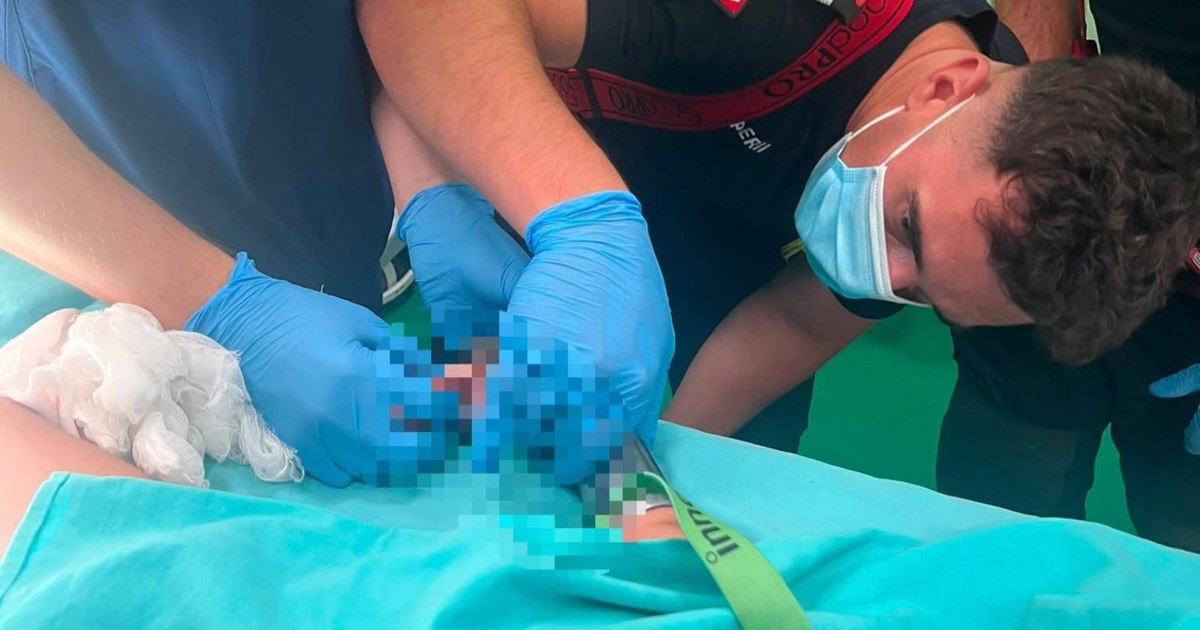 Intervenție dramatică în Mureș: un copilaș de doi ani a rămas cu mâna prinsă în mașina de tocat. Pompierii au intrat în sala de operație