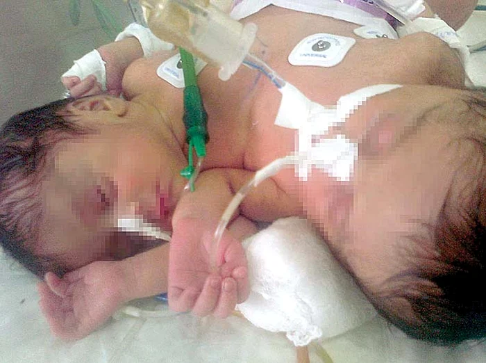 Ștefania și Cristiana s-au născut în 22 decembrie 2015