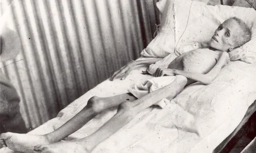 Cele mai terifiante experimente medicale cunoscute vreodată jpeg