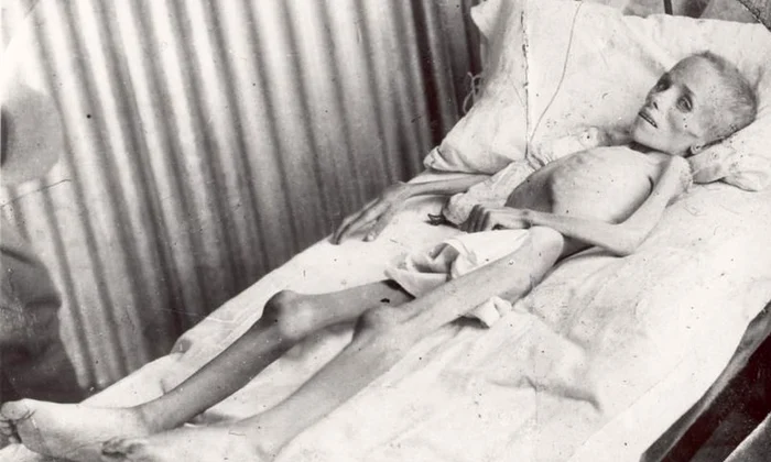 Cele mai terifiante experimente medicale cunoscute vreodată jpeg