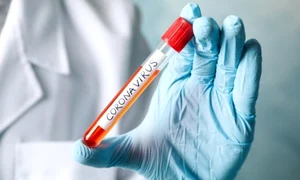 media 158275576323210100 5 jpeg