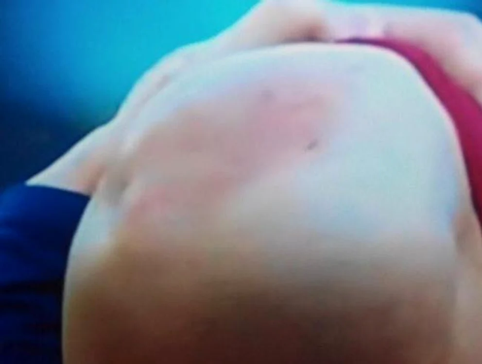 Pe genunchiul lui Messi se văd urmele de la crampoanele adversarului