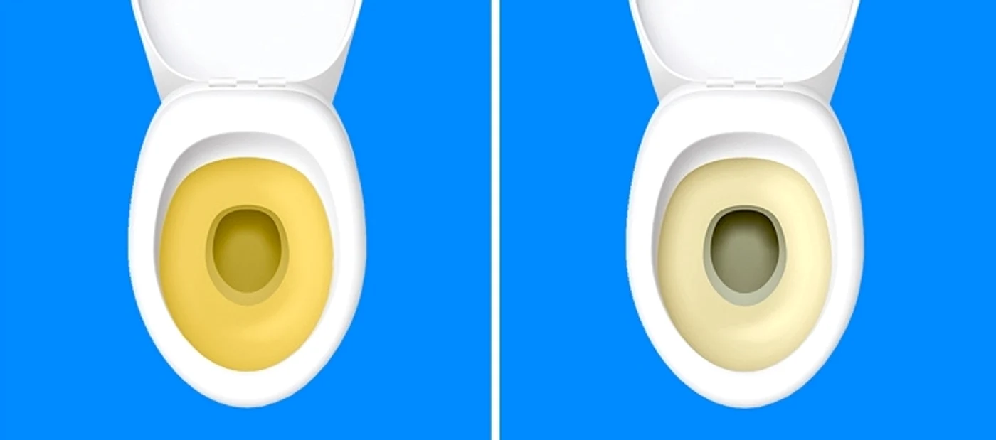 2 observi modificari la urinare uite ce semnal de alarma iti da organismul hmsk jpg jpeg
