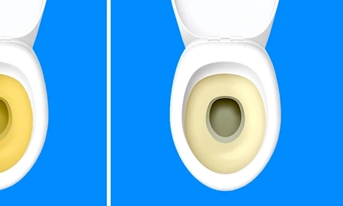 2 observi modificari la urinare uite ce semnal de alarma iti da organismul hmsk jpg jpeg