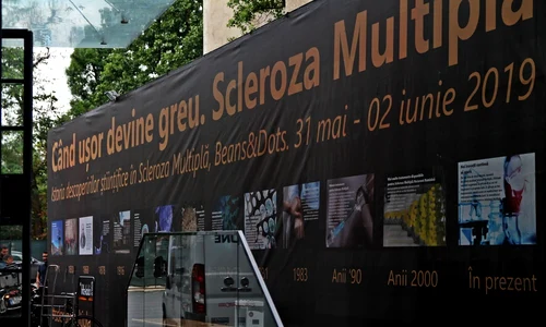 1 scleroza jpg jpeg