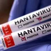 hantavirus who jpg