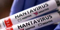 hantavirus who jpg