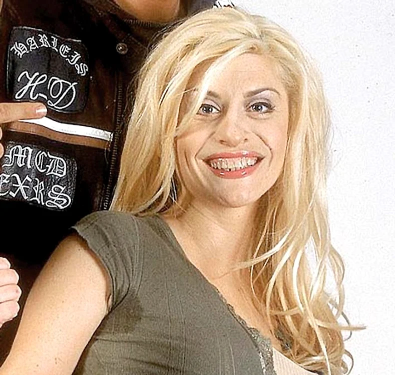 2003. Aceasta e cea mai nereuşită poză a vedetei: dinţii sunt inestetici, iar nasul proeminent