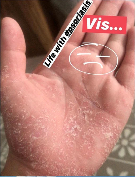 Așa arată mâinile lui Tily Niculae