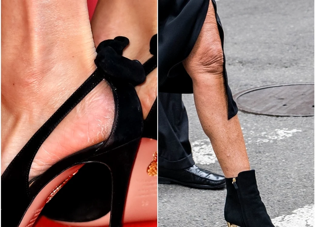 
    Vă vine să credeţi? Astea sunt picioare de vedetă! Foto: Guliver/ Getty Images/ profimedia  
