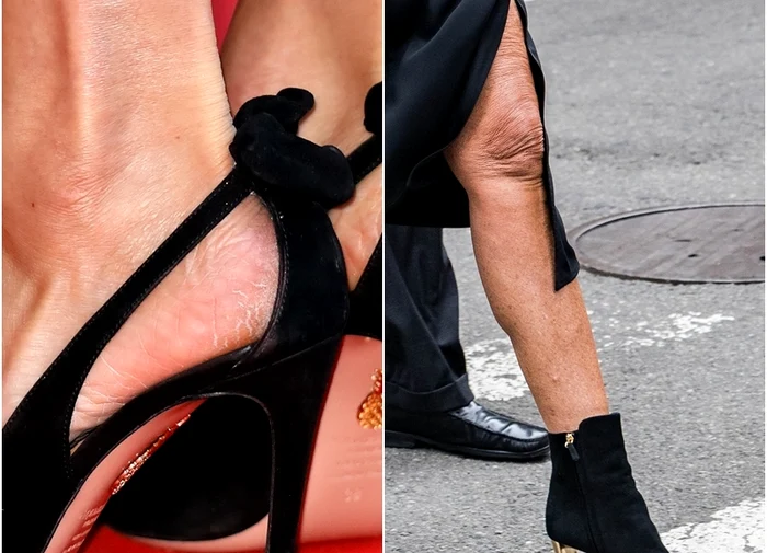 Vă vine să credeţi? Astea sunt picioare de vedetă! Foto: Guliver/ Getty Images/ profimedia