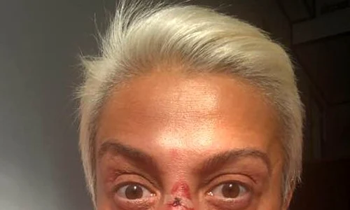 4 monica anghel rani pe fata a cazut de pe cal 2 jpg jpeg