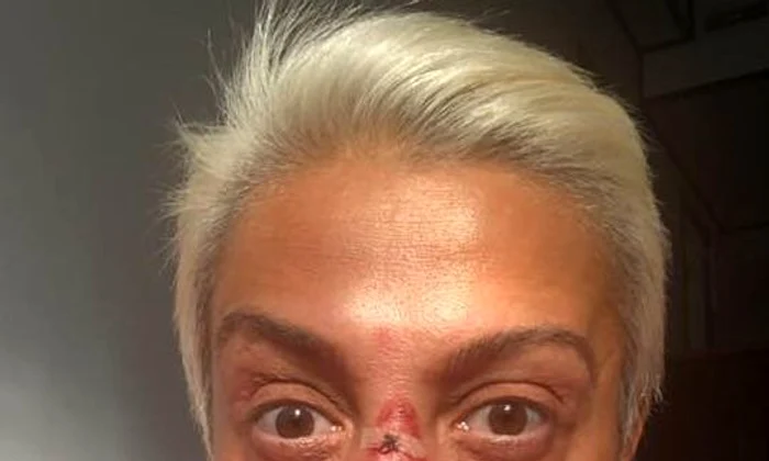 4 monica anghel rani pe fata a cazut de pe cal 2 jpg jpeg