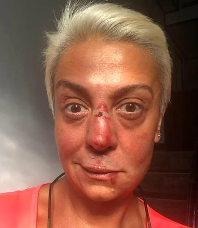 4 monica anghel rani pe fata a cazut de pe cal 2 jpg jpeg