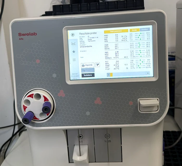 Aparatul îi scapă pe copii de încercările succesive prin metoda clasică FOTO: M.V.