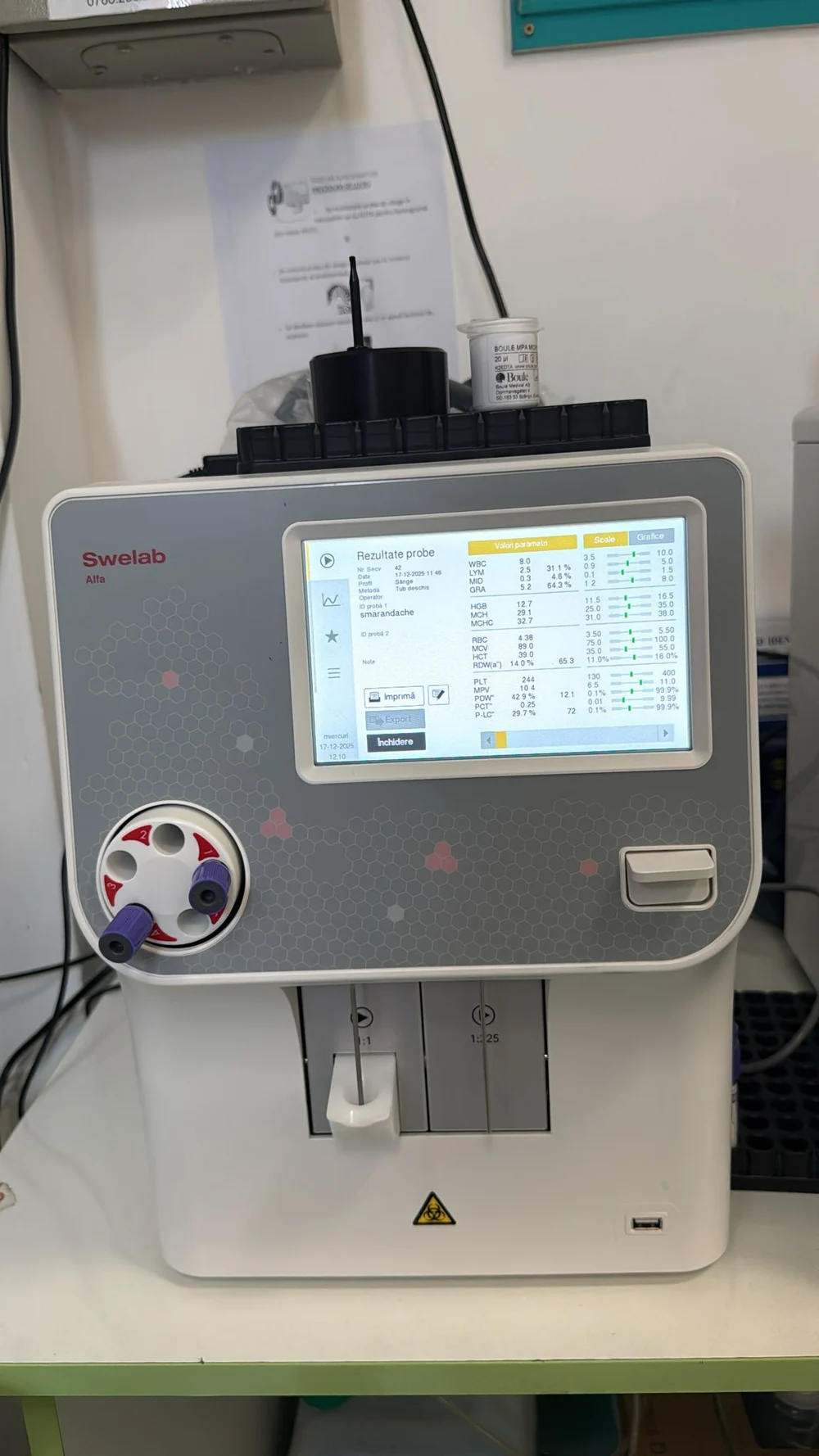 Aparatul care îi scapă pe bebeluși de traume. „Vom recolta din degețel, așa cum se recoltează o banală glicemie”