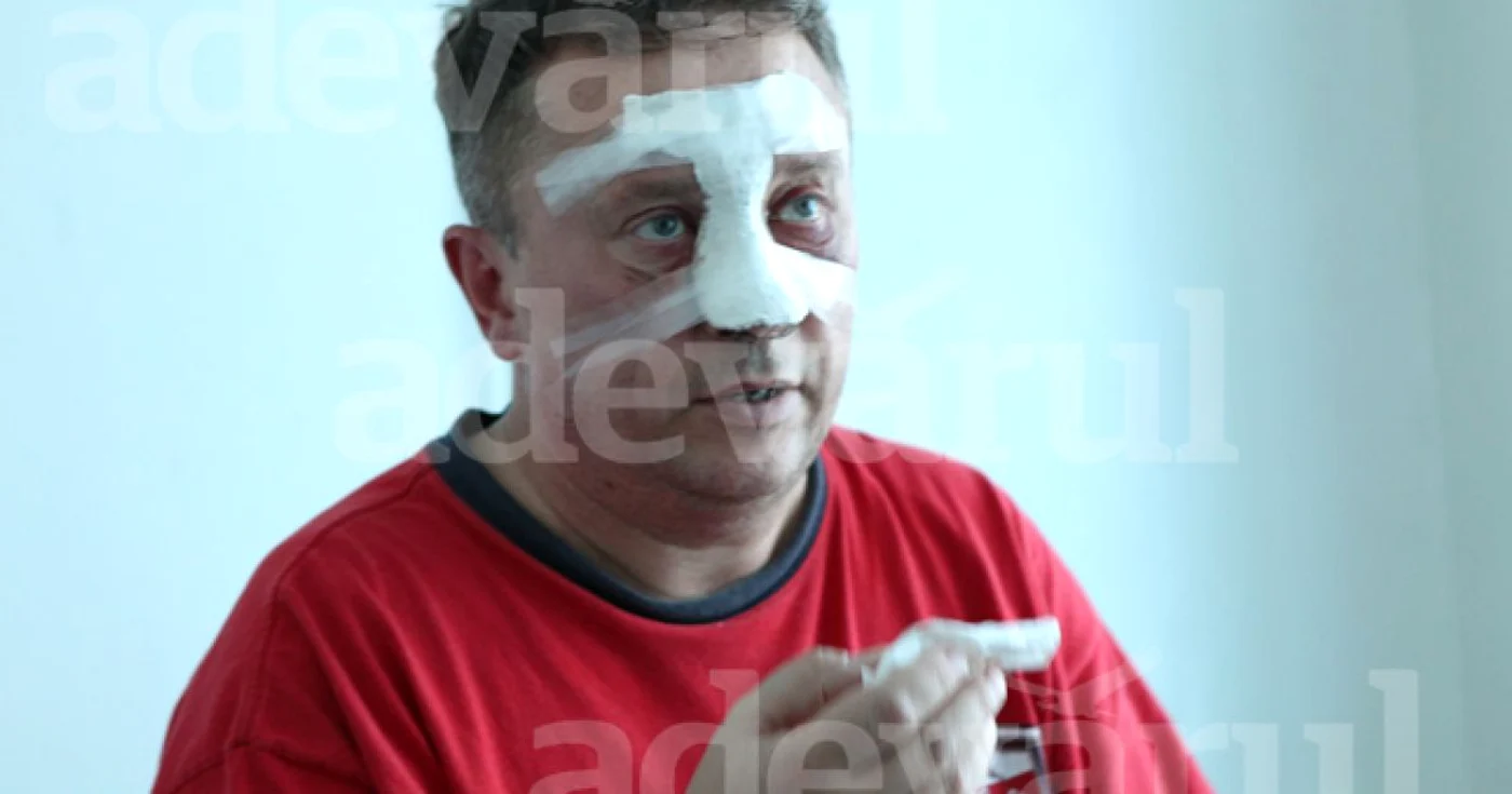 Procurorul Iurie Garaba, după intervenţia chirurgicală de la Spitalul de Urgenţă. FOTO Tudor Iovu
