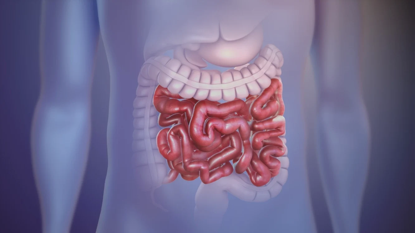 Factorii de risc ai bolilor inflamatorii intestinale
