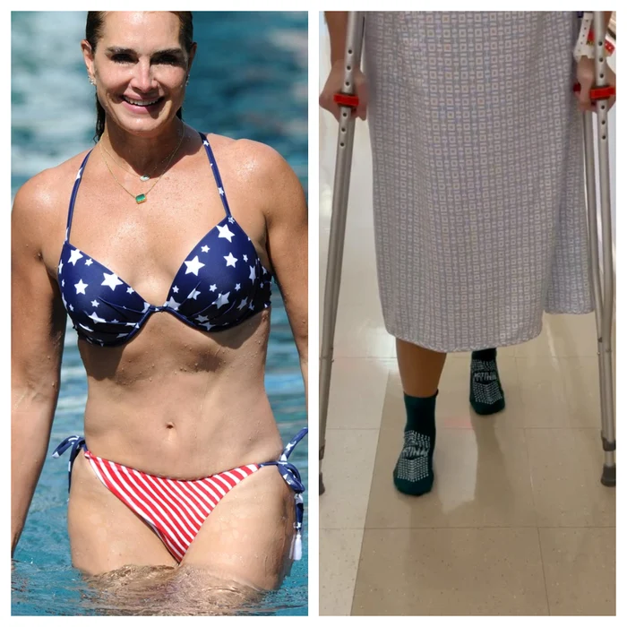 Brooke Shields