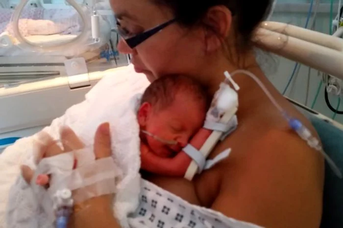 
    Mama a reușit să-și țină copilul în brațe, după ce medicii nu i-au dat șanse de supraviețuire foto: mirror.co.uk  