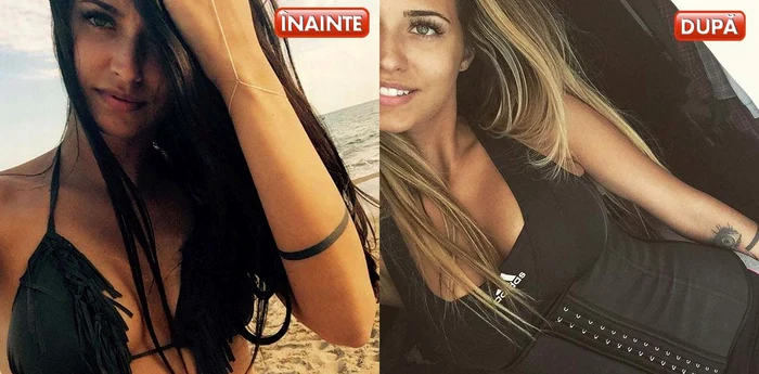 Imagini cu Antonia înainte şi după implantul mamar pe care l-a suferit recent