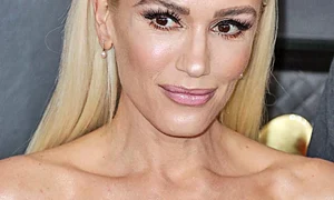 2020  Are faţa îngheţată de la prea multe proceduri estetice jpeg