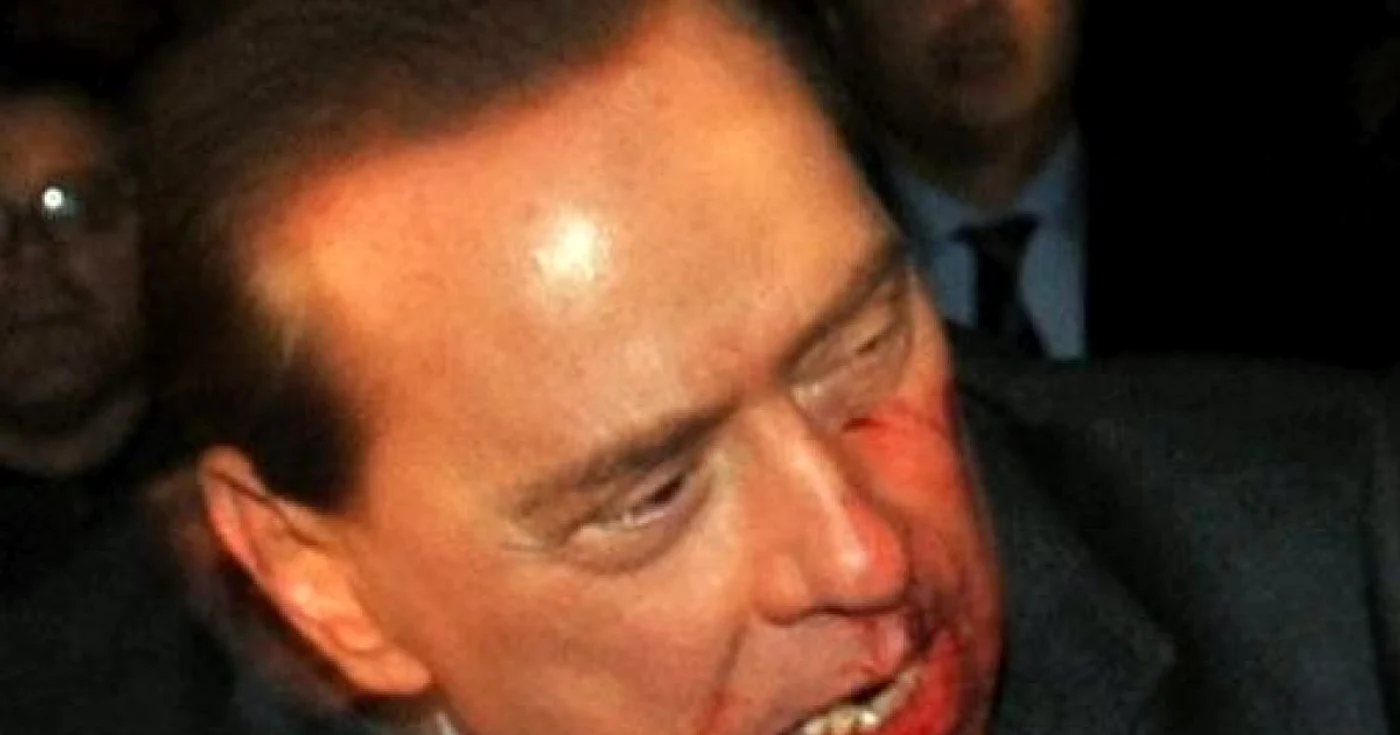 Berlusconi a fost externat de la spitalul ¨San Raffaele¨