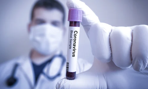 coronavirus 0 jpeg