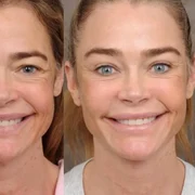 Actrița americană Denise Richards imagini inainte si dupa lifting facial FOTO: Instagram