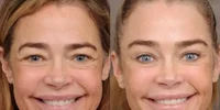 Actrița americană Denise Richards imagini inainte si dupa lifting facial FOTO: Instagram