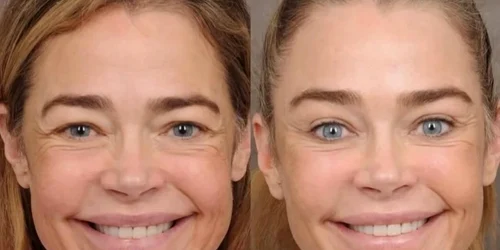 Actrița americană Denise Richards imagini inainte si dupa lifting facial FOTO: Instagram