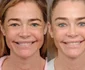 Actrița americană Denise Richards imagini inainte si dupa lifting facial FOTO: Instagram