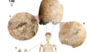 Scheletul T46 prezintă răni la nivelul craniului și uzură neobișnuită a dinților. Zonele întunecate reprezintă oasele care au fost recuperate de arheologi (© International Journal of Paleopathology (2026). DOI: 10.1016/j.ijpp.2026.04.008)