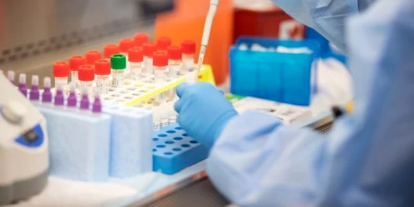 Teste test laborator coronavirus covid pandemie FOTO Guliver Gettyimages / Andrew Theodorakis