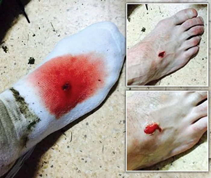 Victoria de la Botoşani a fost plătită scump de căpitanul mureşenilor, care a încheiat meciul cu o gaură în picior