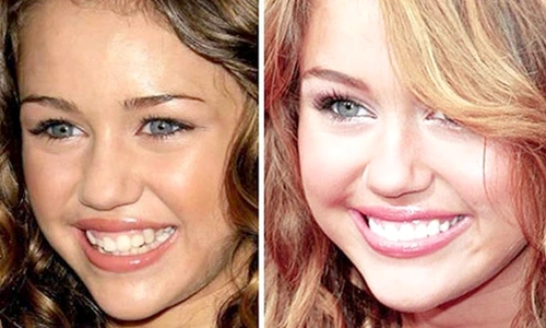 1 76866 original jpg jpeg