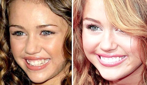 1 76866 original jpg jpeg