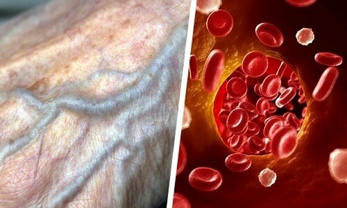 1 69196 original jpg jpeg