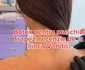 Ilinca Vandici a testat botoxul pentru trapez la doctor Iancu Morad foto: Instagram