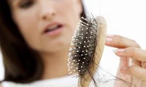 1 caderea parului jpg jpeg