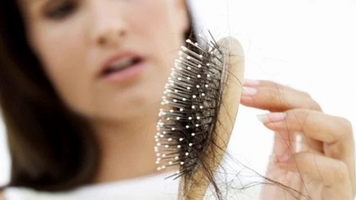 Căderea părului. Foto: arhiva.
