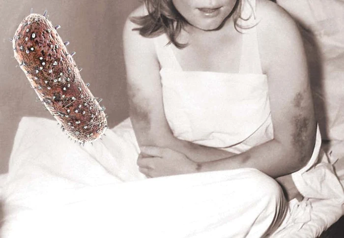 Cei care se îmbolnăvesc de febră hemoragică virală au răni care sângerează incontrolabil