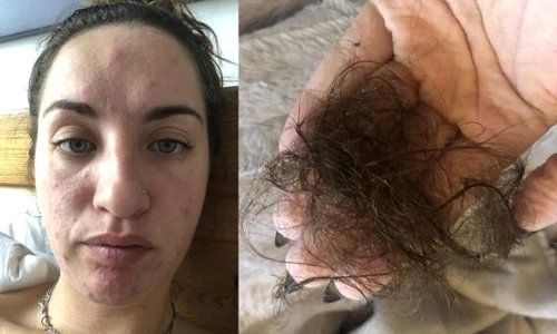 1 mucegaiul din casa un real pericol ce a patit o femeie 11 jpg jpeg